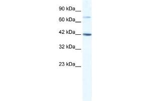 WB Suggested Anti-GLI4 Antibody Titration:  1. (GLI4 抗体  (N-Term))