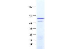 Western Blotting (WB) image for Zinc Finger Protein 529 (ZNF529) protein (His tag) (ABIN2736064)