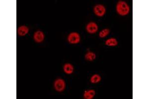 ABIN6274880 staining 293 by IF/ICC. (ABCA6 抗体  (Internal Region))