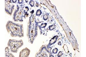 Immunohistochemistry (IHC) image for anti-BCL2-Associated X Protein (BAX) (AA 17-48) antibody (ABIN5647494)