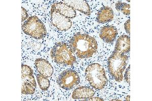 IHC analysis of RASAL1 using anti-RASAL1 antibody (ABIN6719367).