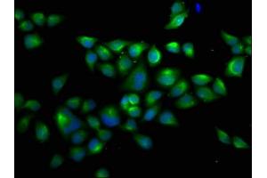 Immunofluorescence staining of Hela cells with ABIN7174520 at 1:66, counter-stained with DAPI. (UBA1 抗体  (AA 730-881))