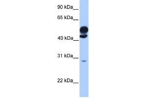 KLC3 antibody used at 1 ug/ml to detect target protein. (KLC3 抗体  (Middle Region))