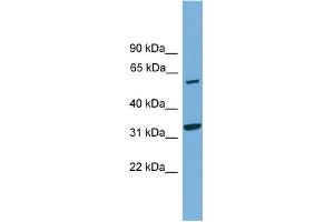 WB Suggested Anti-XPNPEP3 Antibody Titration: 0. (XPNPEP3 抗体  (N-Term))