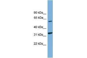 WB Suggested Anti-XPNPEP3 Antibody Titration: 0.