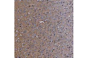 IHC analysis of TTC7B using anti-TTC7B antibody (ABIN7601050). (TTC7B 抗体  (AA 275-730))