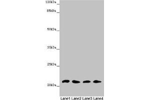 Western blot All lanes: MSRB3 antibody at 4. (MSRB3 抗体  (AA 1-185))