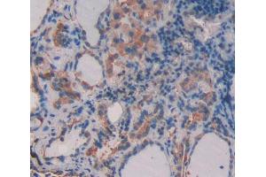 Used in DAB staining on fromalin fixed paraffin- embedded thyroid tissue (CD164 抗体  (AA 24-162))