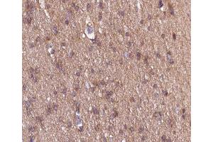 ABIN6266533 at 1/100 staining human brain tissue sections by IHC-P. (COL18A1 抗体  (C-Term))