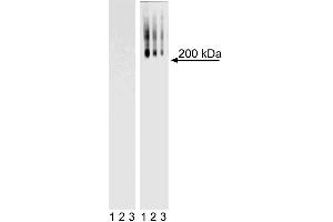 Western Blot analysis of TRA-1-60 in mouse and human ES cell lines. (TRA1-60 抗体)