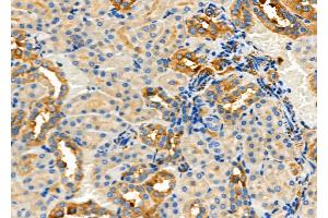 ABIN6260581 and ABIN6277918 at 1/100 staining Rat kidney tissue by IHC-P.