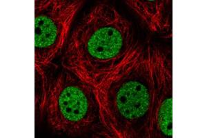 Immunofluorescent staining of MCF7 cells with HNRNPC monoclonal antibody, clone CL2596  (Green) shows distinct nuclear (without nucleoli). (HNRNPC 抗体)