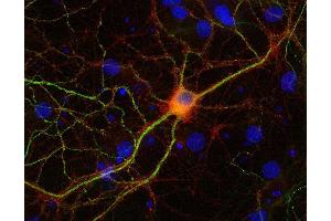 Indirect immunostaining of PFA fixed rat hippocampus neurons with anti-NSF (dilution 1 : 500; red) and mouse anti-MAP 2 (cat. (NSF 抗体)