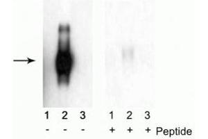 Western blot of immunoprecipitates from HEK 293 cells transfected with 1) Mock, 2) IFNAR1 WT, and 3) IFNAR1 S535A and S539A mutants. (IFNAR1 抗体  (pSer535, pSer539))