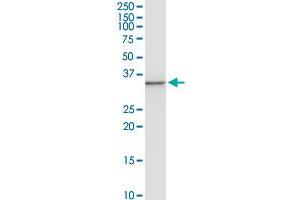 ANXA3 MaxPab rabbit polyclonal antibody. (Annexin A3 抗体  (AA 1-323))