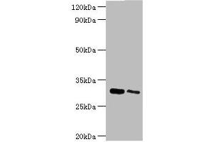 Western blot All lanes: Chloride intracellular channel protein 4 antibody at 5 μg/mL Lane 1: Mouse kidney tissue Lane 2: Mouse ovarian tissue Secondary Goat polyclonal to rabbit IgG at 1/10000 dilution Predicted band size: 29 kDa Observed band size: 29 kDa (CLIC4 抗体  (AA 1-253))