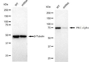 Western blotting analysis using PKC alpha antibody (ABIN7799989).