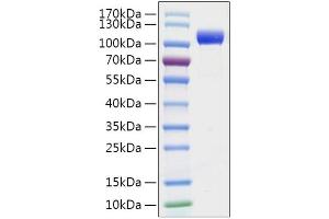 Recombinant 2019-nCoV Spike S1 Protein with His tag was determined by SDS-PAGE with Coomassie Blue, showing a band at 110-130 kDa. (SARS-CoV-2 Spike S1 Protein (His tag))