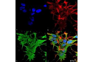 Immunofluorescence (fixed cells) (IF/ICC) image for anti-Dicer 1, Ribonuclease Type III (DICER1) (AA 1638-1899) antibody (ABIN1686625)