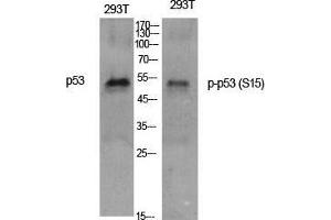 Western Blot (WB) analysis of specific cells using Phospho-p53 (S15) Polyclonal Antibody. (p53 抗体  (pSer15))