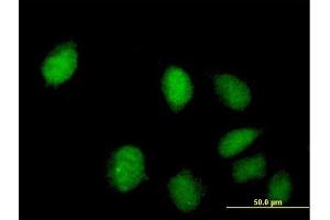 Immunofluorescence of purified MaxPab antibody to C8orf70 on HeLa cell. (FAM164A 抗体  (AA 1-325))