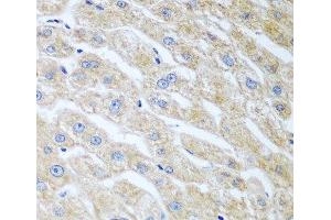 Immunohistochemistry of paraffin-embedded Human liver using UCHL3 Polyclonal Antibody at dilution of 1:100 (40x lens). (UCHL3 抗体)