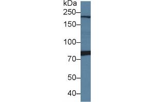 Detection of PI4Ka in Rat Cerebrum lysate using Polyclonal Antibody to Phosphatidylinositol-4-Kinase Catalytic Alpha (PI4Ka) (PI4KA 抗体  (AA 1-300))