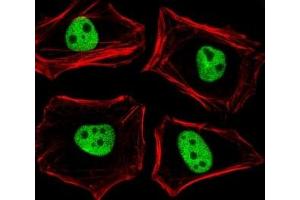 Fluorescent image of HeLa cells stained with TLE1 antibody diluted at 1:25 dilution. (TLE1 抗体  (N-Term))
