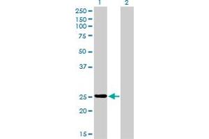 Western Blot analysis of PSPH expression in transfected 293T cell line by PSPH monoclonal antibody (M02), clone 2G9. (PSPH 抗体  (AA 1-225))