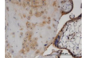 Immunoperoxidase of monoclonal antibody to EZR on formalin-fixed paraffin-embedded human placenta.