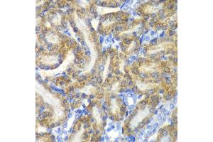 Immunohistochemistry of paraffin-embedded rat kidney using FAH antibody at dilution of 1:100 (x40 lens). (FAH 抗体)
