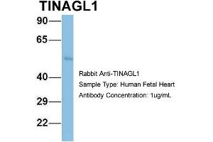 Host: Rabbit Target Name: TINAGL1 Sample Type: Human Fetal Heart Antibody Dilution: 1. (TINAGL1 抗体  (Middle Region))