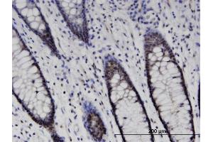 Immunoperoxidase of monoclonal antibody to SETD7 on formalin-fixed paraffin-embedded human colon. (SETD7 抗体  (AA 257-366))