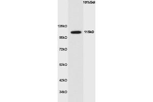 Human colon cancer lysate probed with Anti Phospho-Ack1(Tyr284) Polyclonal Antibody, Unconjugated  at 1:3000 for 90 min at 37˚C. (TNK2 抗体  (pTyr284))