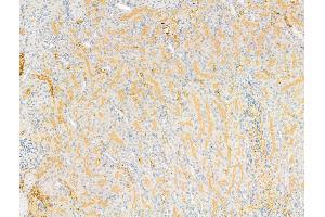 DPP9 - Catalytic domain Antibody at 1/100 staining Rat kidney tissue by IHC-P.