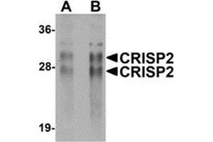 Western blot analysis of CRISP2 in human testis tissue lysate with CRISP2 antibody at (A) 0. (CRISP2 抗体  (N-Term))