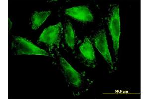 Immunofluorescence of monoclonal antibody to RFNG on HepG2 cell. (RFNG 抗体  (AA 82-190))