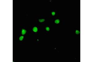Immunofluorescent analysis of HepG2 cells using ABIN7144946 at dilution of 1:100 and Alexa Fluor 488-congugated AffiniPure Goat Anti-Rabbit IgG(H+L) (ACLY 抗体  (AA 4-265))