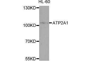 Western blot analysis of extracts of HL-60 cells, using ATP2A1 antibody. (ATP2A1/SERCA1 抗体)