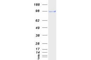 Western Blotting (WB) image for SRY (Sex Determining Region Y)-Box 13 (SOX13) protein (Myc-DYKDDDDK Tag) (ABIN2732431)