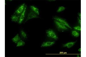 Immunofluorescence of monoclonal antibody to SQSTM1 on HeLa cell. (SQSTM1 抗体  (AA 1-440))