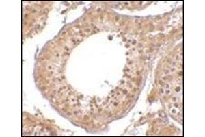 Immunohistochemistry of RGPD5 in human testis tissue cells with this product at 10 μg/ml. (RGPD5 / RGPD6 (N-Term) 抗体)