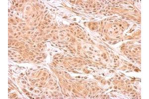 IHC-P Image ZNF134 antibody detects ZNF134 protein at cytosol on Cal27 xenograft by immunohistochemical analysis. (ZNF134 抗体)