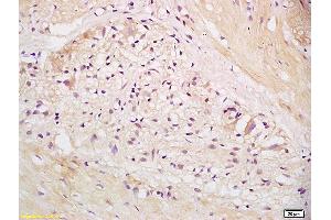 Formalin-fixed and paraffin embedded human stomach labeled with Anti EEA1 Polyclonal Antibody, Unconjugated (ABIN1385839) at 1:200 followed by conjugation to the secondary antibody and DAB staining. (EEA1 抗体  (AA 1251-1350))