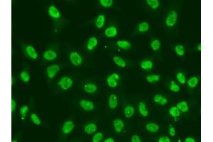 Immunofluorescence analysis of A549 cells using CHEK2 antibody. (CHEK2 抗体)
