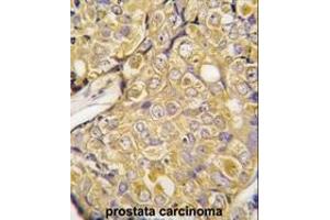 Image no. 2 for anti-Transient Receptor Potential Cation Channel, Subfamily M, Member 8 (TRPM8) (Middle Region) antibody (ABIN360716)