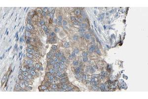 ABIN6276452 at 1/100 staining Human prostate tissue by IHC-P. (TPMT 抗体  (N-Term))