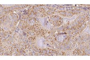 anti-BCL2-Like 11 (Apoptosis Facilitator) (BCL2L11) (pSer77) antibody