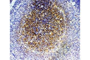 IHC analysis of GRK2 using anti-GRK2 antibody (ABIN5693069). (GRK2 抗体)