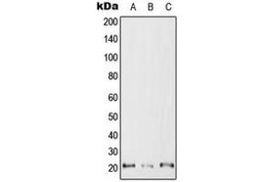 Western blot analysis of RAC2 expression in Jurkat (A), SP2/0 (B), H9C2 (C) whole cell lysates. (RAC2 抗体  (C-Term))